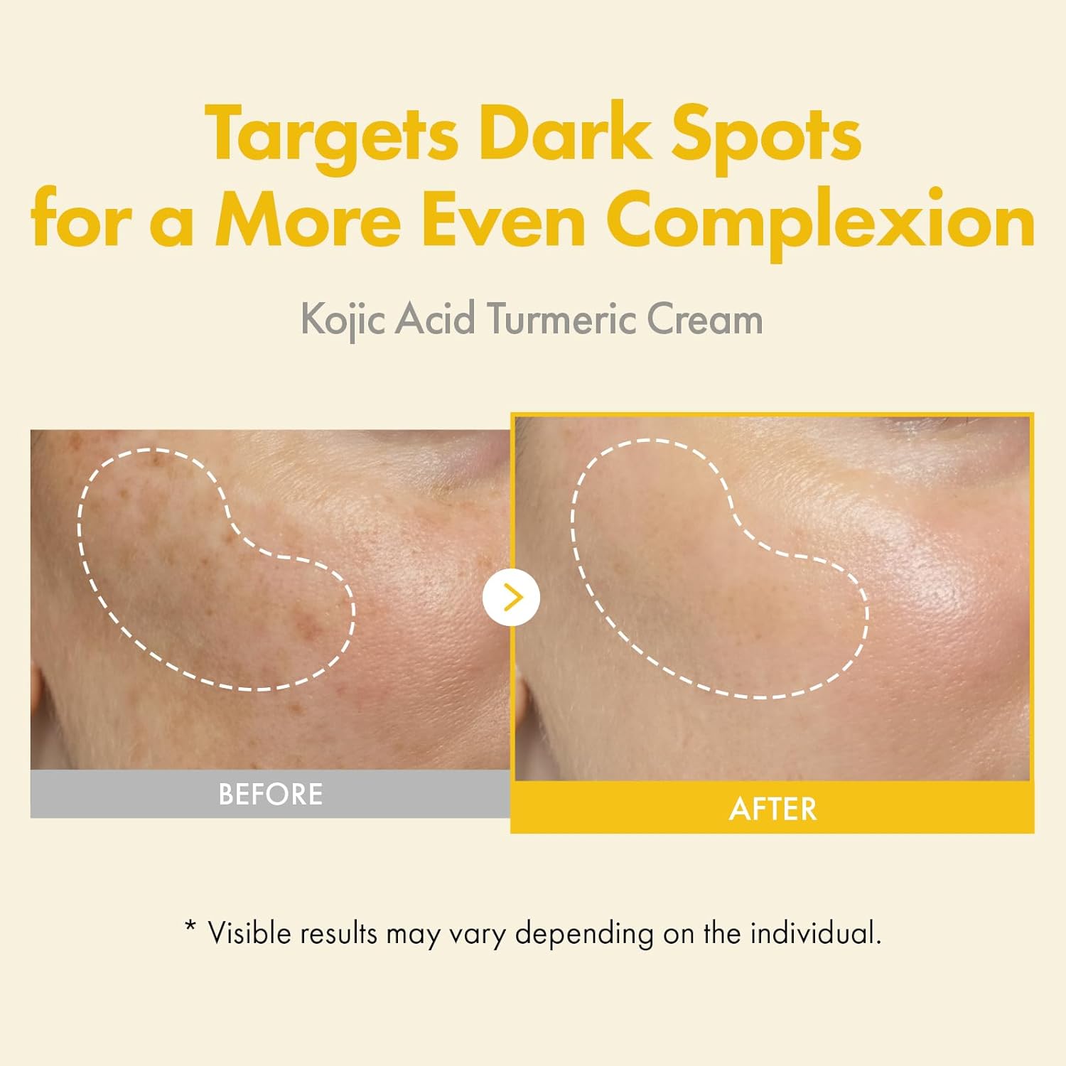 TOSOWOONG product image