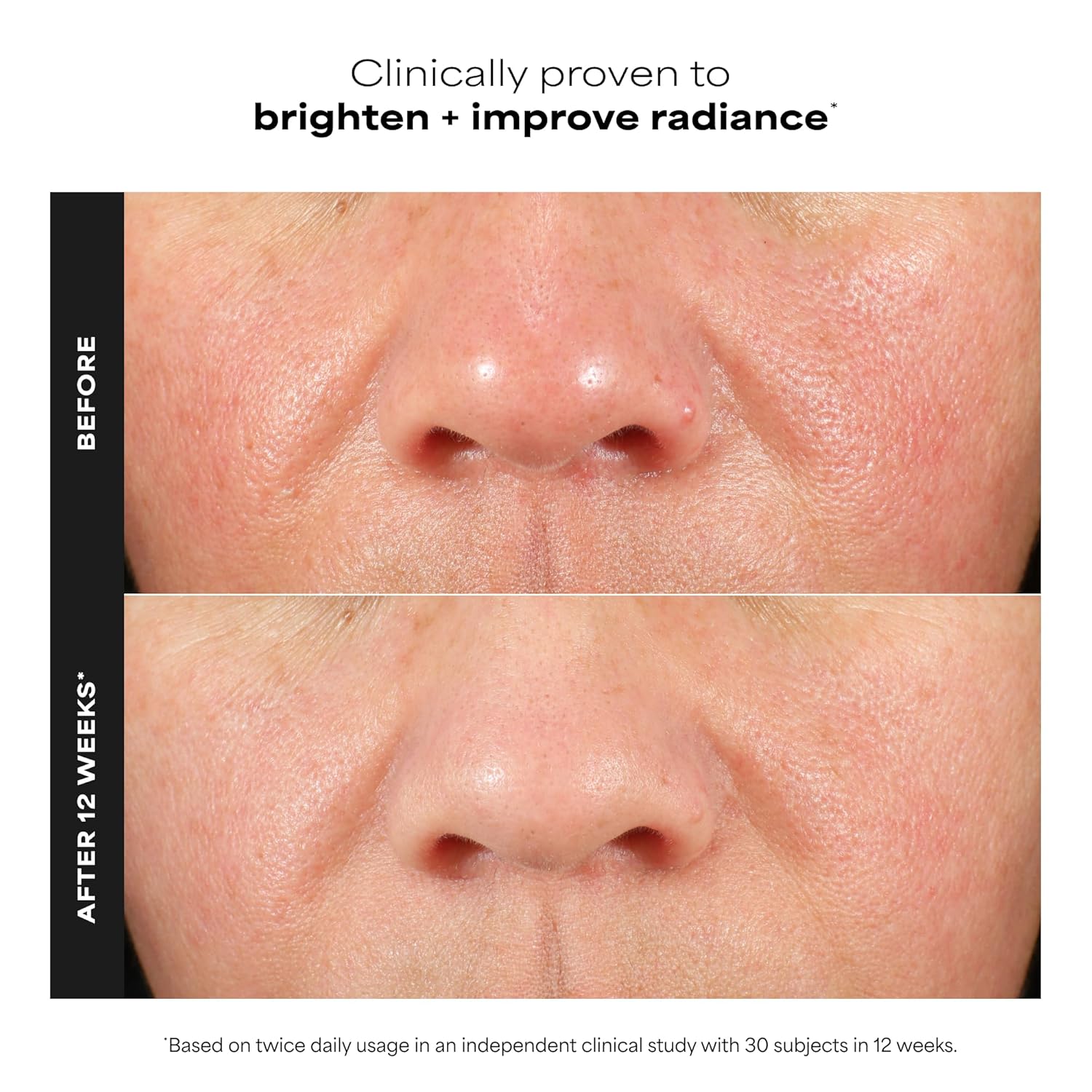 L-Ascorbic Acid Serums Ranked by Concentration, Stability, and Real Efficacy